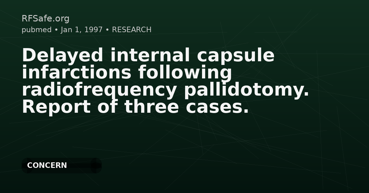 Delayed internal capsule infarctions following radiofrequency pallidotomy. Report of three cases.